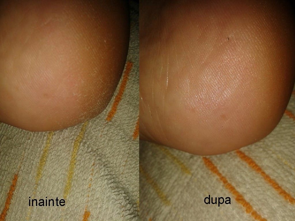 inainte-dupa